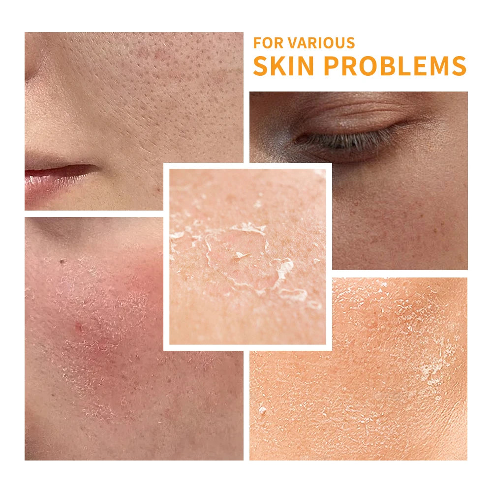 SPF 30 Vitamin C Moisturizer Protects Skin From UV Rays Hydrating Lotion Brightens Skin Nourishment Multiple Skin Care